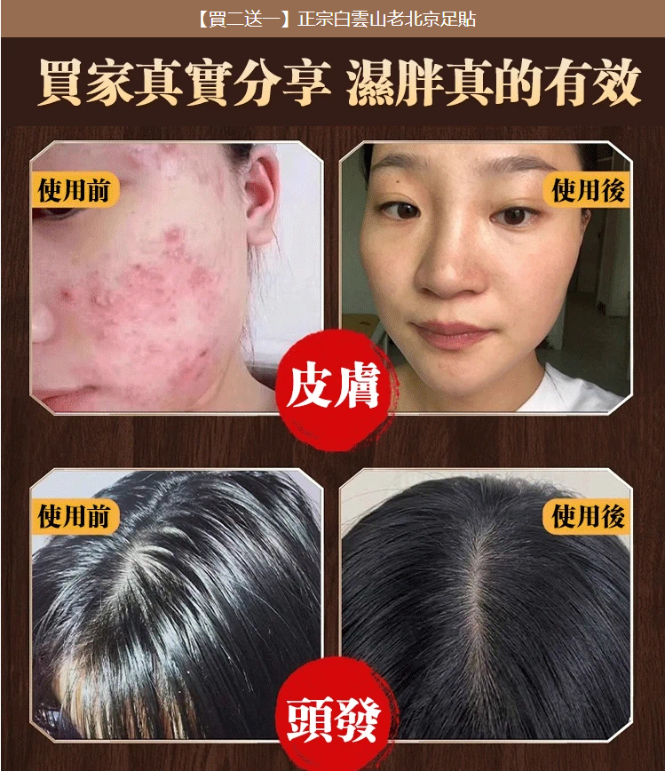 【中藥艾草穴位足貼】珍貴中藥材提取，每晚一貼，助眠除濕氣排油 減輕腰酸背痛，三天見效！ 去濕排毒，消腫止痛，改善睡眠